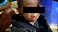 Anak 13 Tahun Jadi Korban Penganiayaan Berat di Ketapang, Pelaku Terancam Pidana Penjara