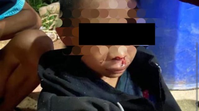 Anak 13 Tahun Jadi Korban Penganiayaan Berat di Ketapang, Pelaku Terancam Pidana Penjara
