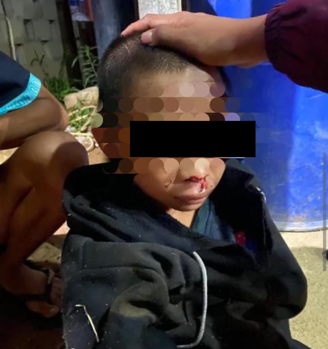 Anak 13 Tahun Jadi Korban Penganiayaan Berat di Ketapang, Pelaku Terancam Pidana Penjara