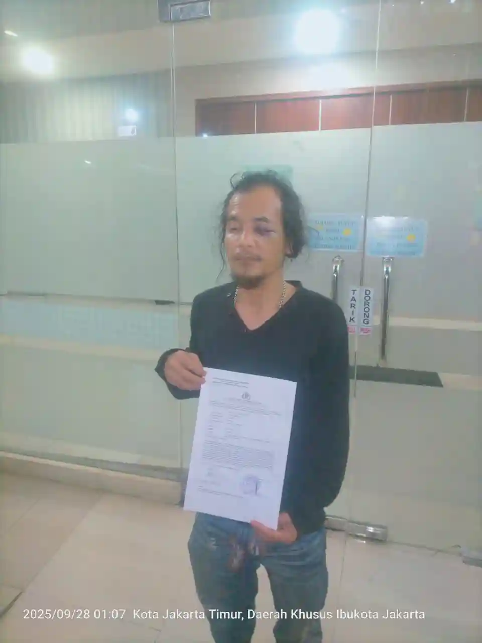 AWIBB Mengecam Keras Pengeroyokan Wartawan di Tambun, Desak Polisi Bertindak Cepat