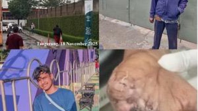 PT. Tri Excella Harmony Diduga Mempermainkan Karyawan Korban Kecelakaan Kerja