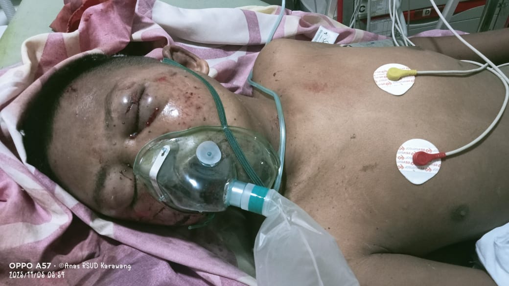 Ketua Umum PPDI: Tindakan Main Hakim Sendiri terhadap Anak Disabilitas di Karawang Tak Bisa Dibenarkan