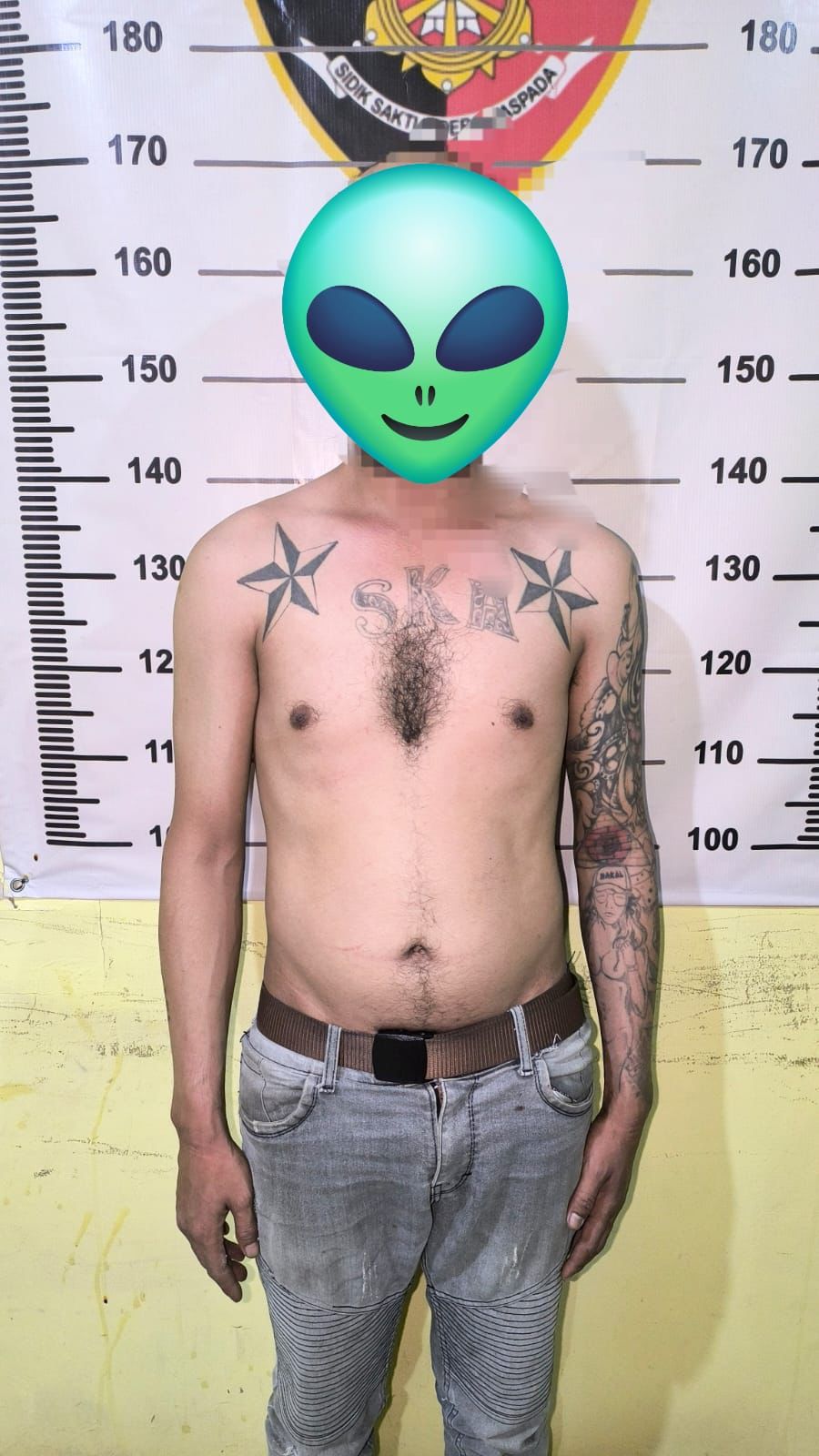 Pria Dibacok di Margaasih, Tiga Luka Menganga di Kepala, Satu Pelaku Diburu Polisi