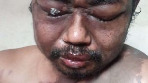 LSM GNRI Kota Bekasi Dorong Prioritas Penyelamatan Korban Tindak Kekerasan dan Perbaikan Sistem Pembiayaan Kesehatan