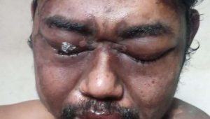 LSM GNRI Kota Bekasi Dorong Prioritas Penyelamatan Korban Tindak Kekerasan dan Perbaikan Sistem Pembiayaan Kesehatan